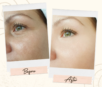 Revival Bio Retinol Coffee Eye Serum