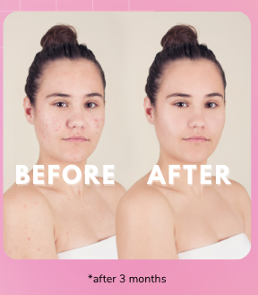 Skin Calming Spot Treatment