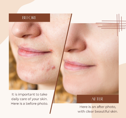 Skin Calming Spot Treatment